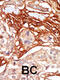 A-Raf Proto-Oncogene, Serine/Threonine Kinase antibody, 63-215, ProSci, Immunohistochemistry paraffin image 