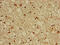 Potassium Voltage-Gated Channel Interacting Protein 3 antibody, CSB-PA012045LA01HU, Cusabio, Immunohistochemistry frozen image 