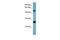 Cordon-Bleu WH2 Repeat Protein Like 1 antibody, GTX47027, GeneTex, Western Blot image 