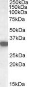 Hydroxyacyl-CoA Dehydrogenase antibody, MBS421179, MyBioSource, Western Blot image 