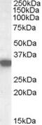 Hydroxyacyl-CoA Dehydrogenase antibody, MBS421179, MyBioSource, Western Blot image 