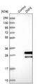 Zinc Finger Protein 8 antibody, NBP1-81755, Novus Biologicals, Western Blot image 