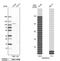 GRAM Domain Containing 1A antibody, NBP1-93730, Novus Biologicals, Western Blot image 