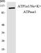 ATPase Na+/K+ Transporting Subunit Alpha 1 antibody, LS-C200155, Lifespan Biosciences, Western Blot image 