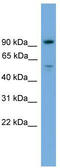 Chromosome 16 Open Reading Frame 71 antibody, TA340328, Origene, Western Blot image 