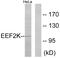 Eukaryotic Elongation Factor 2 Kinase antibody, OAAF00684, Aviva Systems Biology, Western Blot image 