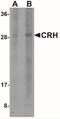 Corticotropin Releasing Hormone antibody, NBP2-41273, Novus Biologicals, Western Blot image 