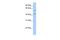 Ephrin A2 antibody, PA5-40353, Invitrogen Antibodies, Western Blot image 