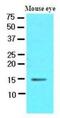 Cellular Retinoic Acid Binding Protein 1 antibody, NBP1-37070, Novus Biologicals, Western Blot image 
