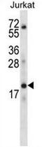 Keratin Associated Protein 1-3 antibody, AP52425PU-N, Origene, Western Blot image 