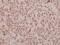 Component Of Inhibitor Of Nuclear Factor Kappa B Kinase Complex antibody, PA5-36718, Invitrogen Antibodies, Immunohistochemistry frozen image 
