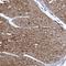 Diglyceride kinase iota antibody, HPA021924, Atlas Antibodies, Immunohistochemistry frozen image 