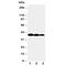 Interleukin 12B antibody, R30540, NSJ Bioreagents, Western Blot image 