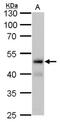 Fumarate Hydratase antibody, NBP2-43578, Novus Biologicals, Western Blot image 