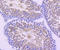 Dynein Axonemal Intermediate Chain 1 antibody, A07656-1, Boster Biological Technology, Immunohistochemistry frozen image 