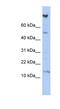 NOTCH Regulated Ankyrin Repeat Protein antibody, NBP1-56421, Novus Biologicals, Western Blot image 