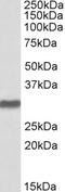 Cartilage Intermediate Layer Protein antibody, 45-402, ProSci, Western Blot image 