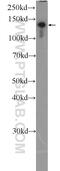 CCAAT Enhancer Binding Protein Zeta antibody, 25612-1-AP, Proteintech Group, Enzyme Linked Immunosorbent Assay image 