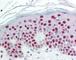 SET Nuclear Proto-Oncogene antibody, 49-309, ProSci, Immunohistochemistry frozen image 