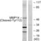 Matrix Metallopeptidase 14 antibody, abx015604, Abbexa, Western Blot image 