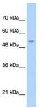 Lecithin-Cholesterol Acyltransferase antibody, TA346168, Origene, Western Blot image 