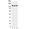 Neurotrophic Receptor Tyrosine Kinase 3 antibody, R31098, NSJ Bioreagents, Western Blot image 