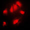 NFKB Inhibitor Alpha antibody, GTX32224, GeneTex, Immunofluorescence image 