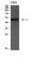 Autophagy Related 4D Cysteine Peptidase antibody, STJ91761, St John