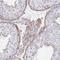 F-Box And Leucine Rich Repeat Protein 13 antibody, HPA057232, Atlas Antibodies, Immunohistochemistry paraffin image 