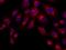 Cathepsin D antibody, 12517-R003, Sino Biological, Immunohistochemistry paraffin image 