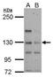 Tubulin Tyrosine Ligase Like 4 antibody, GTX122610, GeneTex, Western Blot image 