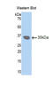 Gap Junction Protein Beta 3 antibody, LS-C300303, Lifespan Biosciences, Western Blot image 