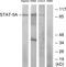 Signal Transducer And Activator Of Transcription 5A antibody, LS-C118254, Lifespan Biosciences, Western Blot image 