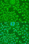 Cyclin D2 antibody, 18-075, ProSci, Immunofluorescence image 