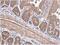 Enoyl-CoA Hydratase 1 antibody, NBP1-31662, Novus Biologicals, Immunohistochemistry paraffin image 