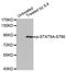 Signal Transducer And Activator Of Transcription 5A antibody, STJ22418, St John