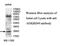 Ankyrin Repeat Domain 49 antibody, MBS416665, MyBioSource, Western Blot image 