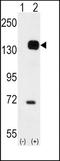 TEK Receptor Tyrosine Kinase antibody, TA300046, Origene, Western Blot image 