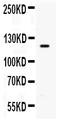 Toll Like Receptor 8 antibody, PA1734, Boster Biological Technology, Western Blot image 