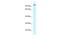 Cyclin Dependent Kinase 11A antibody, A08209, Boster Biological Technology, Western Blot image 