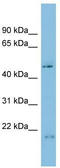 Chromosome 17 Open Reading Frame 75 antibody, TA344685, Origene, Western Blot image 