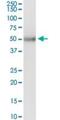 Keratin 83 antibody, H00003889-D01P, Novus Biologicals, Western Blot image 