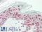 GLI Family Zinc Finger 1 antibody, LS-C790090, Lifespan Biosciences, Immunohistochemistry paraffin image 