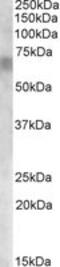 Retinoid Isomerohydrolase RPE65 antibody, MBS420643, MyBioSource, Western Blot image 