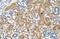 Glycosylphosphatidylinositol Anchor Attachment 1 antibody, NBP1-62435, Novus Biologicals, Immunohistochemistry paraffin image 