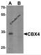 Chromobox 4 antibody, 7007, ProSci, Western Blot image 