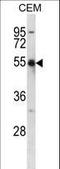 Potassium Voltage-Gated Channel Subfamily A Member 2 antibody, LS-C165409, Lifespan Biosciences, Western Blot image 