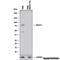 ATP Binding Cassette Subfamily D Member 1 antibody, NBP2-46476, Novus Biologicals, Western Blot image 