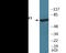 Interleukin 1 Receptor Associated Kinase 1 antibody, EKC2301, Boster Biological Technology, Western Blot image 