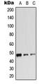 Adrenoceptor Beta 2 antibody, LS-C351816, Lifespan Biosciences, Western Blot image 